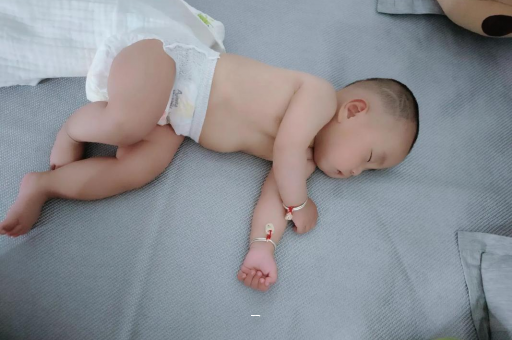 阳谷宝宝脸上有白色斑块
